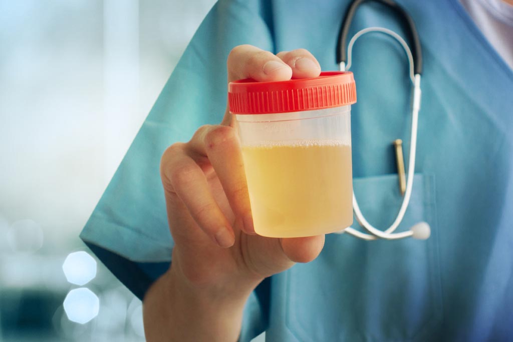 Urine-Sample